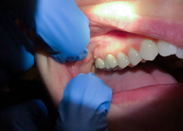 Best Walk-In Emergency Dentist in Orchard Hills, PA